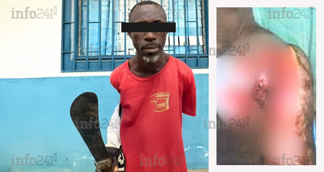 Nkoltang : Un ghanéen cocufié tente de trancher le cou de son rival gabonais à la machette