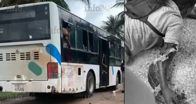 Libreville&nbsp;: Un élève du lycée technique se coupe le bras droit à bord d’un bus scolaire